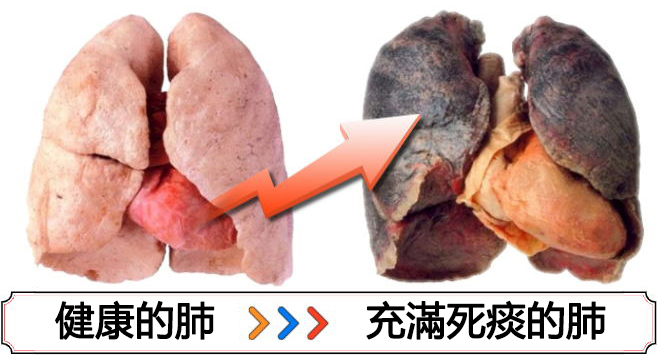 日本戒菸棒